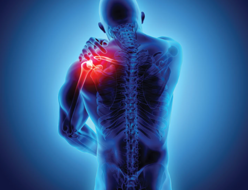 Schouderrevalidatie: kennis en behandeling up-to-date